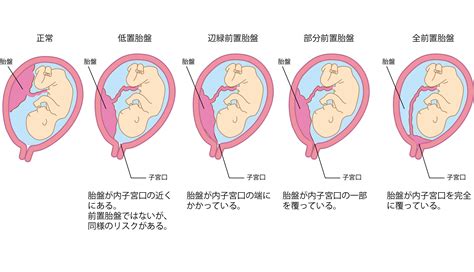 胎盤形成時期|胎盤の重要な役割と前置胎盤などのトラブル